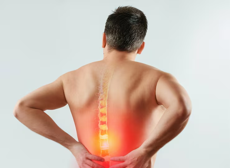 Back Pain